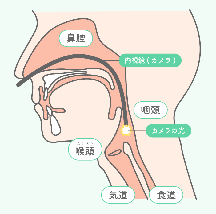 図15_2